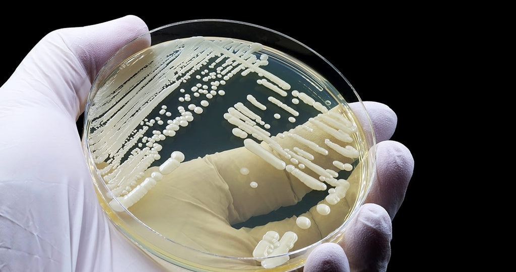 What the Fungus? Candida Auris Outbreak 2024 Explained