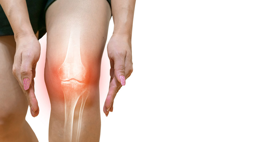 Knee joint inflammation visualization highlighting areas supplements may support