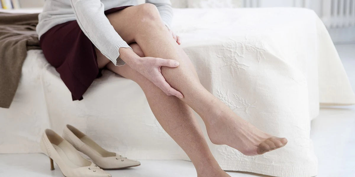 Summer Ready Legs Managing Varicose Veins Health Hispanica Health