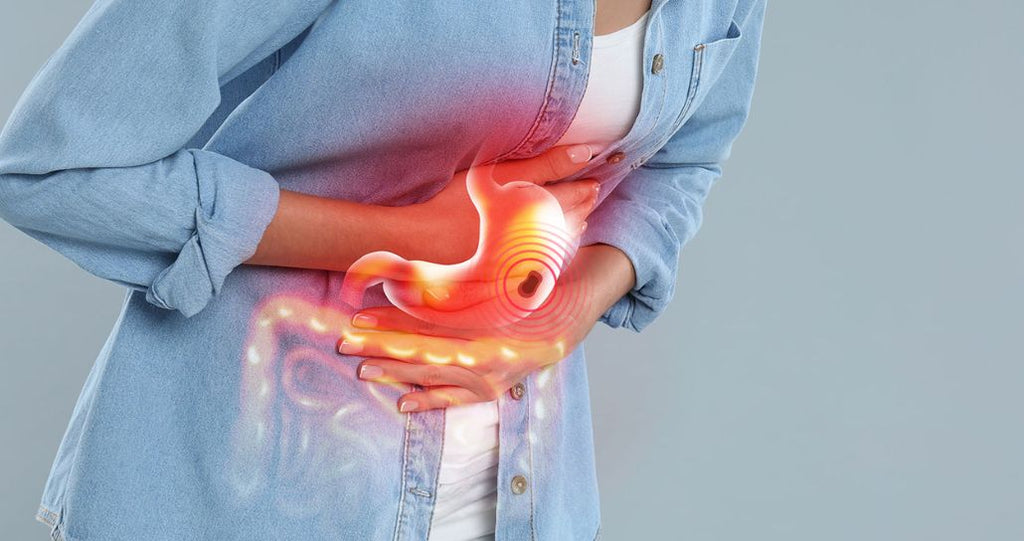 Stomach Ulcers Explained: Symptoms, Causes & Natural Relief with Ulcerex™