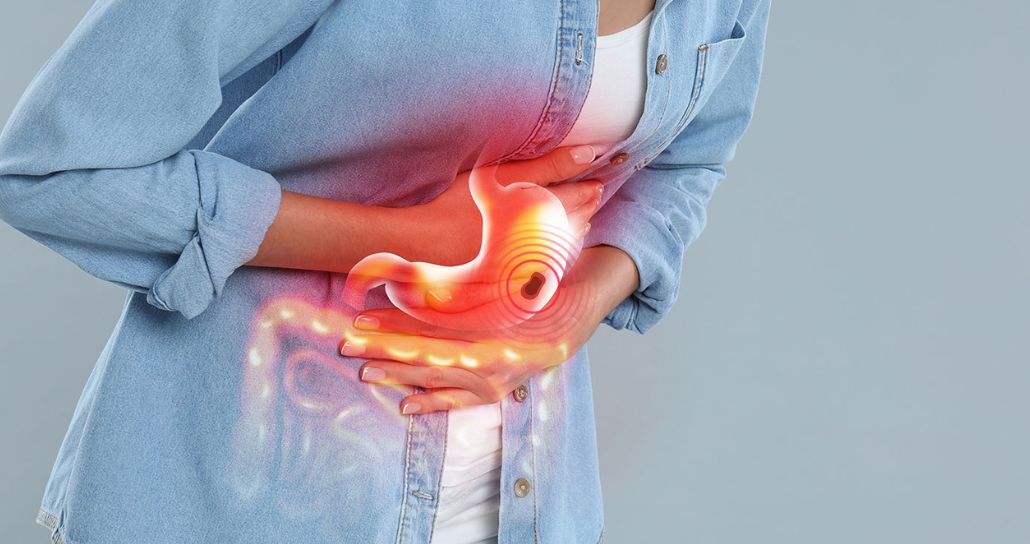 Stomach Ulcers Explained: Symptoms, Causes & Natural Relief with Ulcerex™