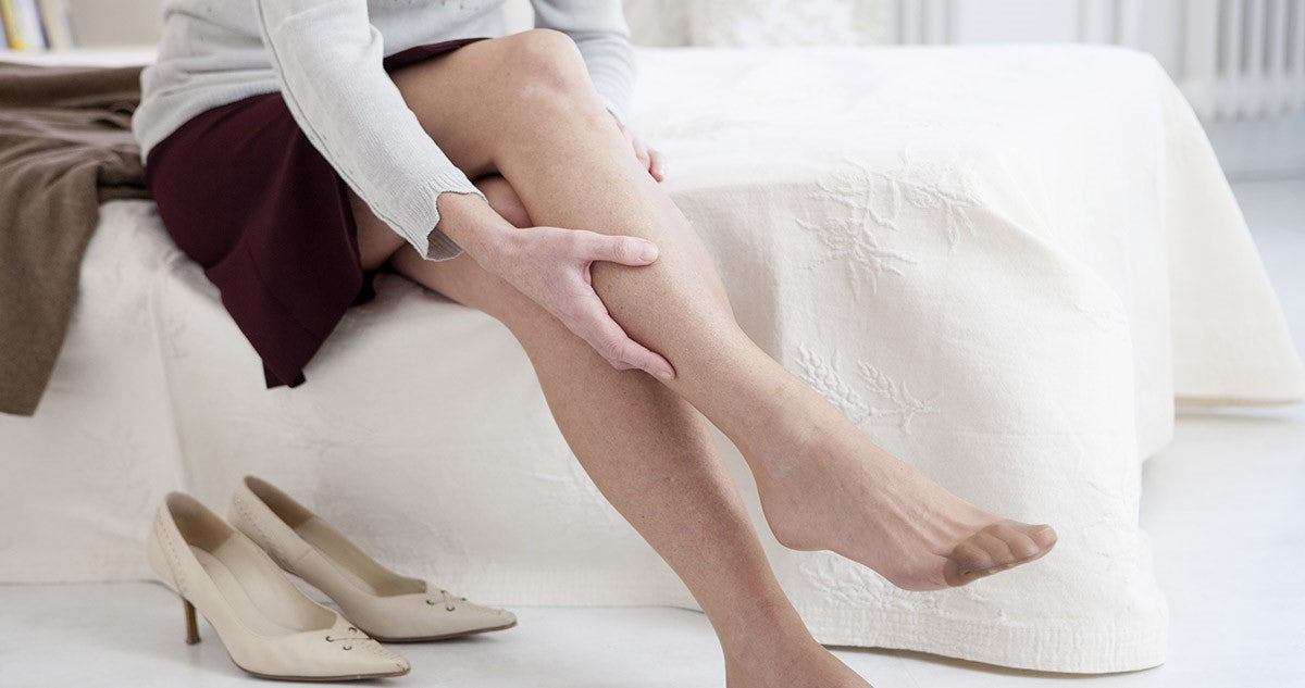 Summer-Ready Legs: Managing Varicose Veins